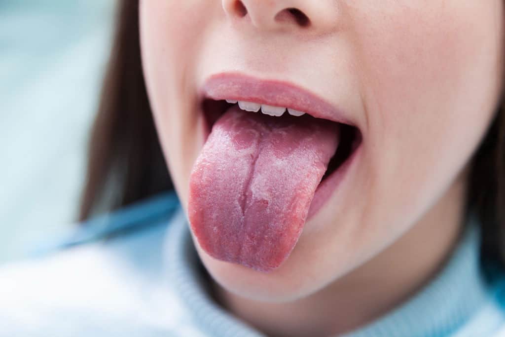 Lengua Geográfica: ¿Qué es y cómo tratarla?