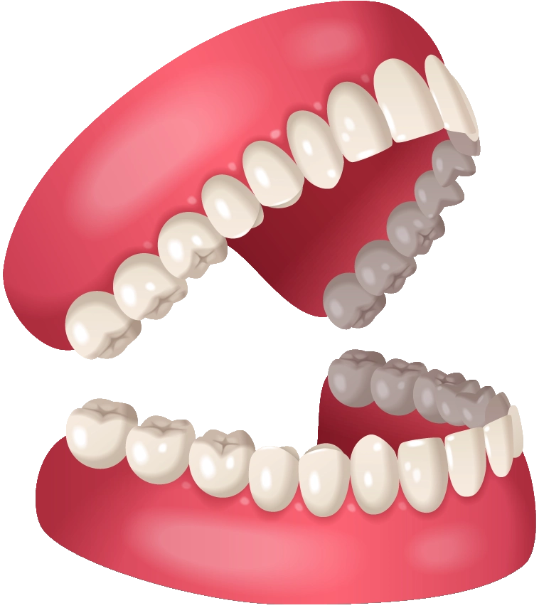 Ilustración dental